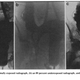 Illustration for article titled This Chemist Discovered How to Salvage Useless Photos with a Dash of Radioactivity